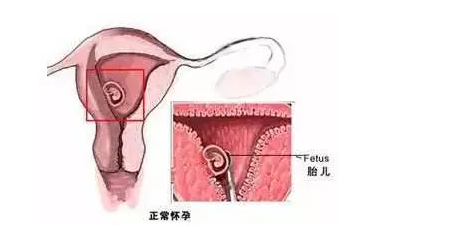 流产会使子宫壁变薄吗