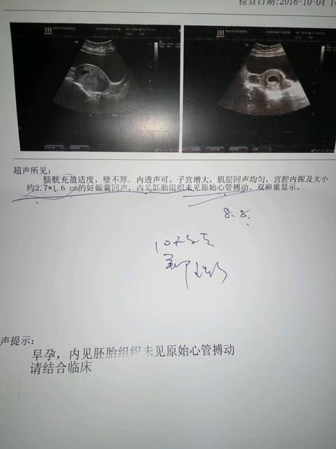 怀孕六个月胎儿图