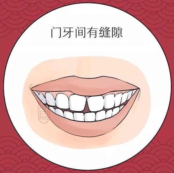 8岁孩子牙齿缝隙大是怎么回事