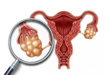 宫颈癌筛查什么时候去查比较好