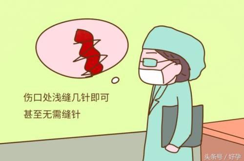 顺产会阴撕裂怎么缓解痛疼
