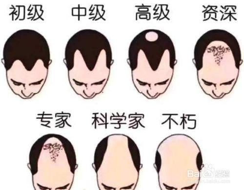 人一年要掉多少根头发