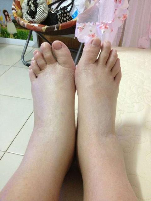 怀孕八个月就有奶正常吗