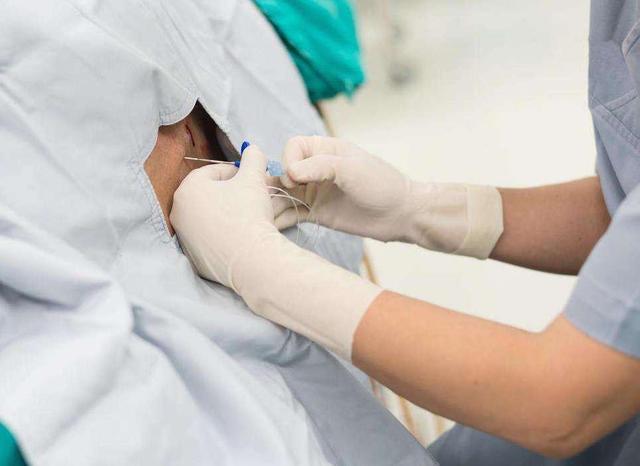 头胎是剖腹产二胎也必须剖腹产吗