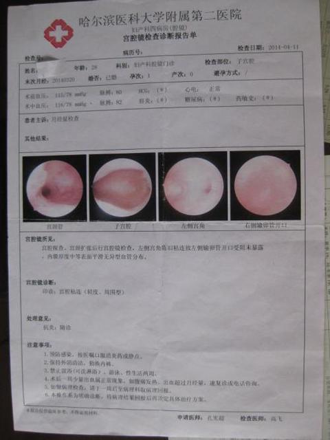 宫腔粘连是怎么引起的?