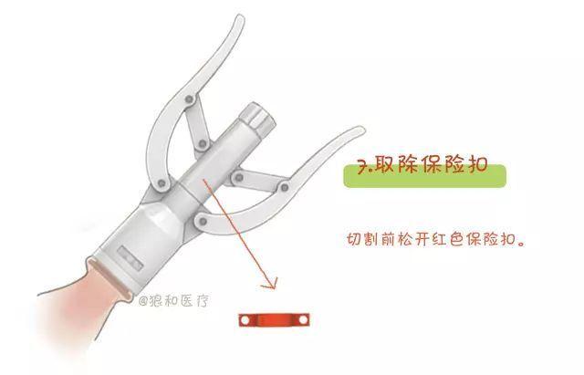 做了包茎手术会不会影响性生活