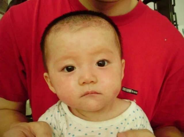 幼儿急疹的护理方法