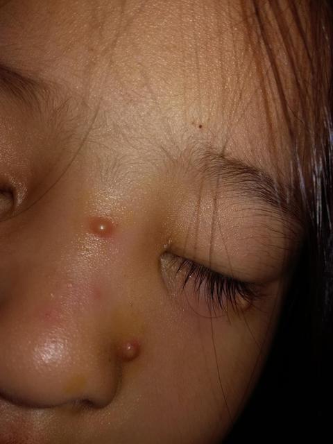 一岁宝宝喉咙有痰怎么办