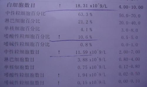 孩子发热是什么原因引起的