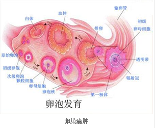 代谢性疾病会导致不孕吗