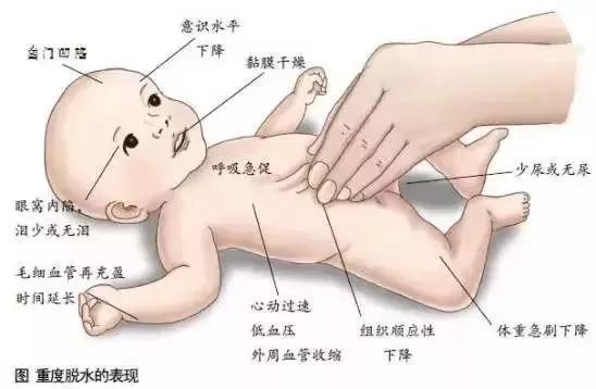 春季宝宝反复发烧怎么办