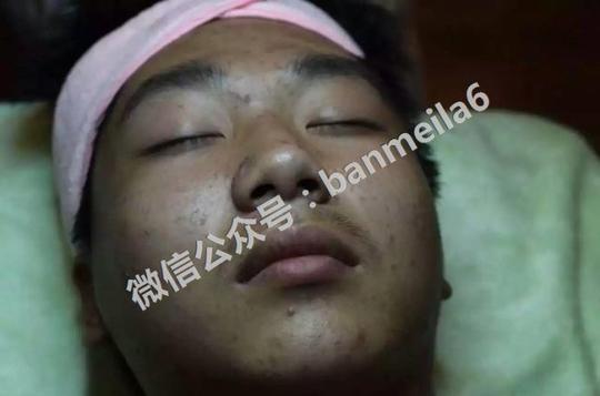 斑美拉面部排毒骗局?