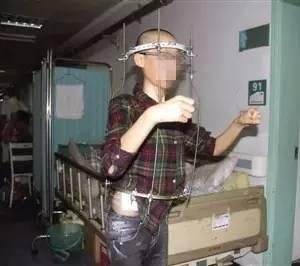 如何预防儿童脊柱侧弯