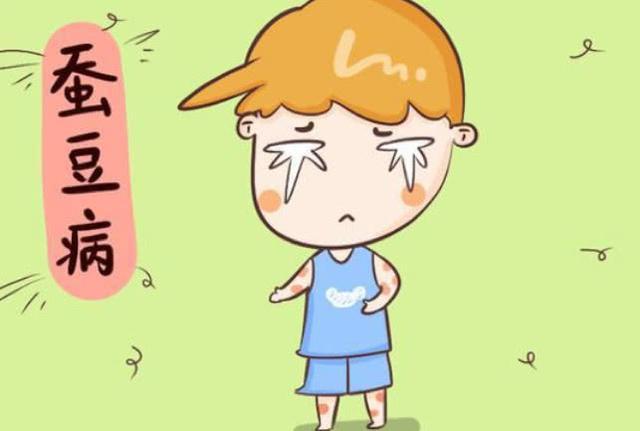 蚕豆病不能吃什么药