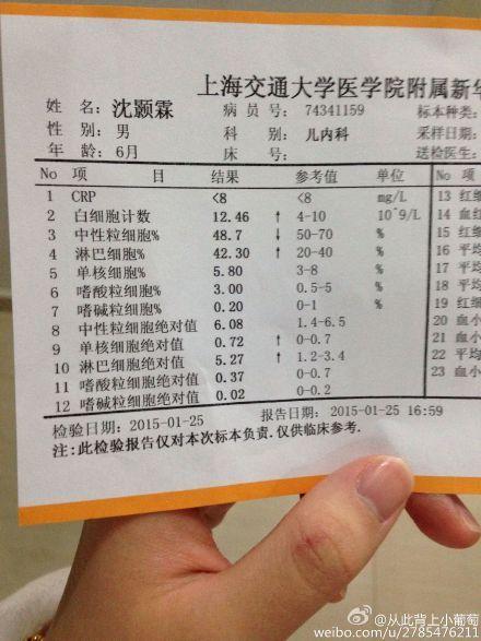 肠气重为什么影响B超