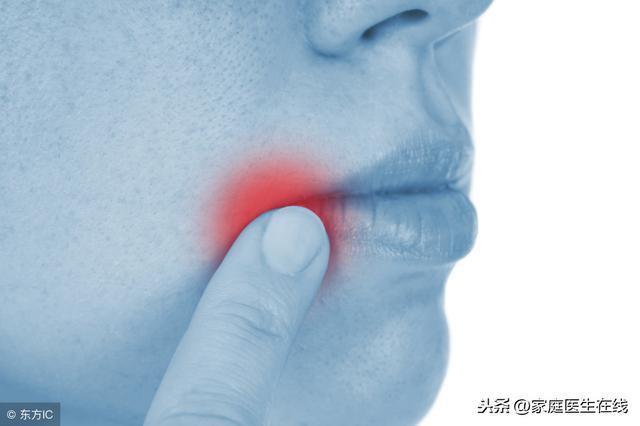 儿童口腔溃疡和便秘