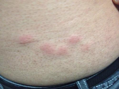 为什么挠自己不痒别人挠就痒