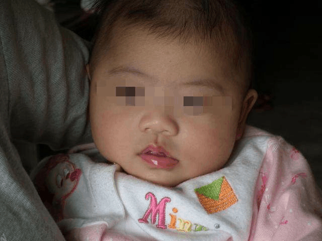 正确区别婴儿吐奶的原因