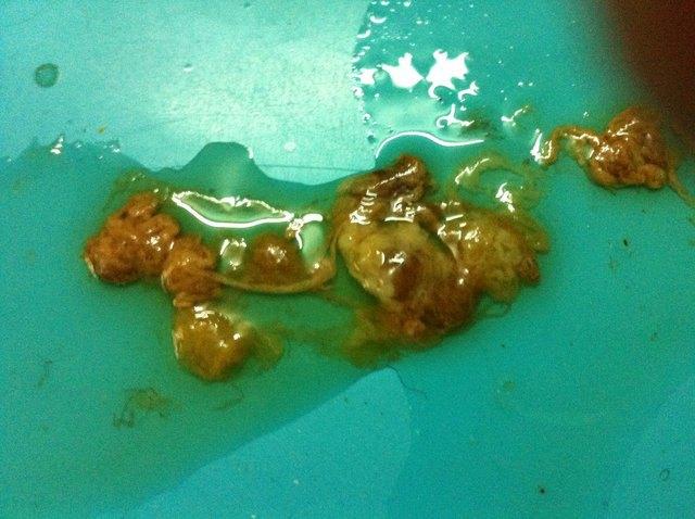 小孩有蛔虫怎么办?