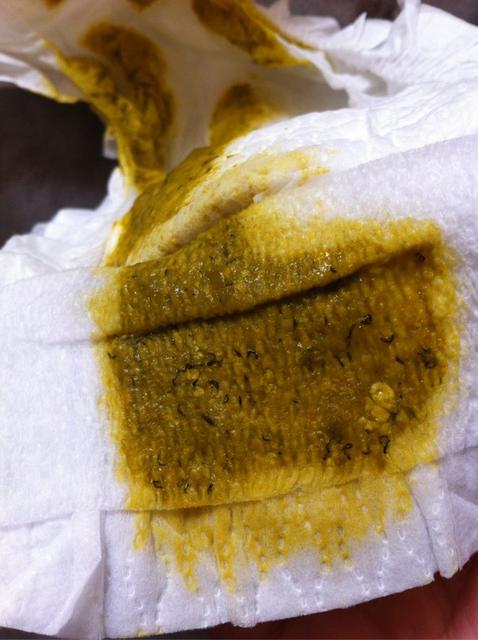 婴儿吃了不消化的东西怎么办