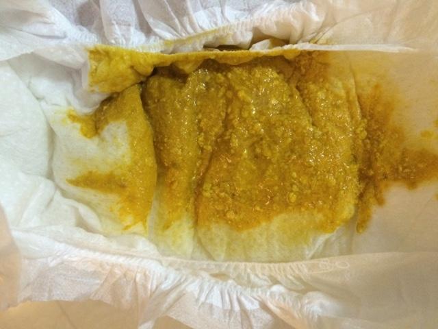 宝宝腹泻怎么办?