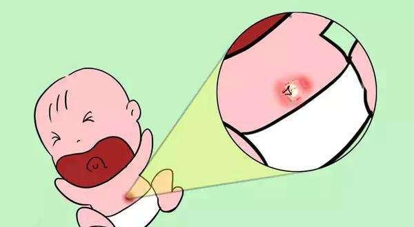 新生儿的脐带一般什么时候脱落