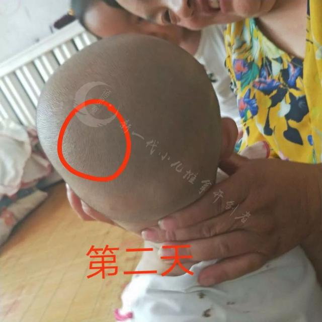 宝宝夏天如何防蚊虫叮咬