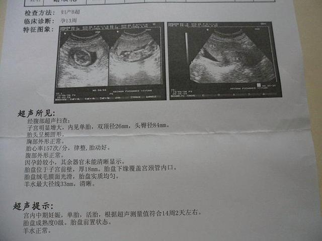 孕期的几项重要检查以及检查时间