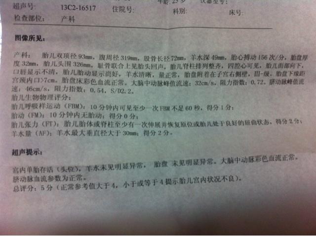 孕晚期需要控制体重吗