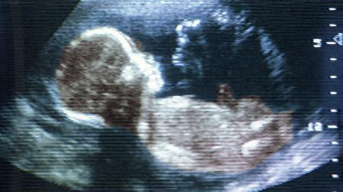 胎儿16周发育情况