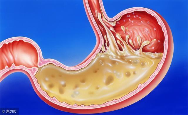 孩子急性腹泻吃什么药