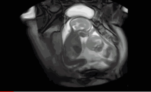 胎儿每个阶段发育重点