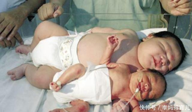 孩子出生的体重越重智商越高吗