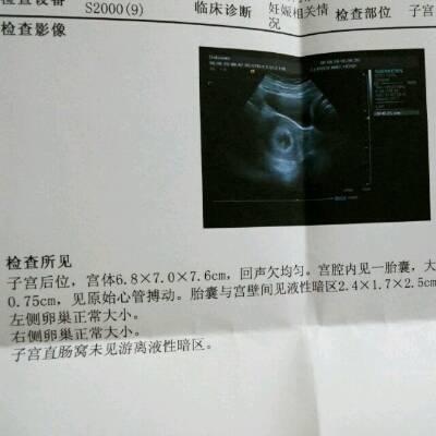 怀孕8周见红是怎么回事啊