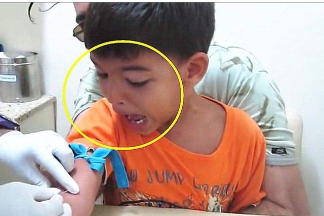 孩子应该打哪些疫苗