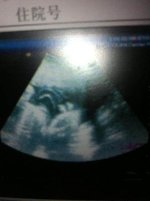 怀孕8个月胎儿b超图片