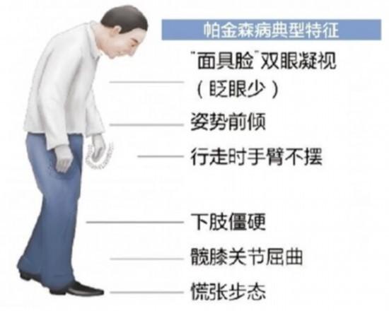 不由自主的手抖是怎么回事