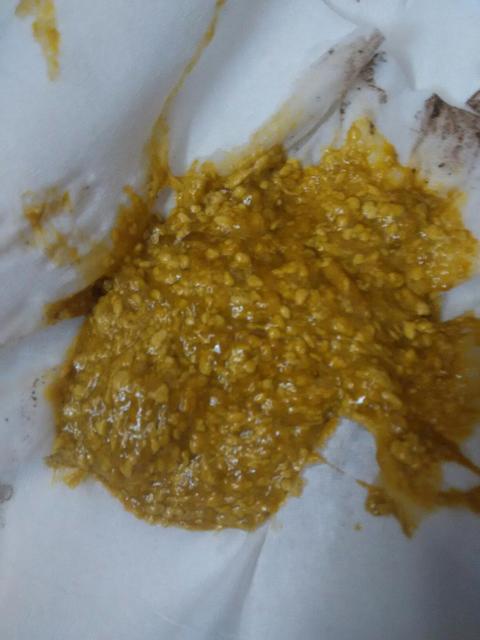 孩子拉奶瓣和奶粉有关系吗