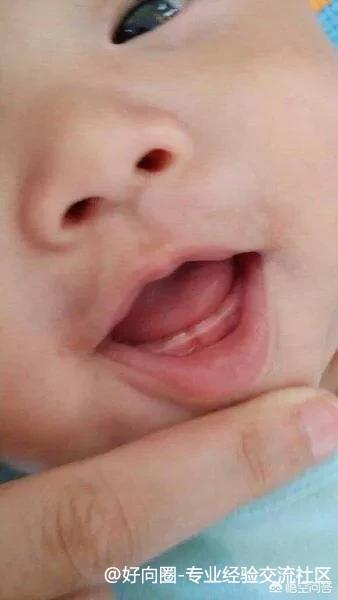 母乳宝宝的牙齿保健