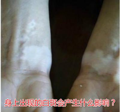 潜在抑郁症在生活中的表现有哪些