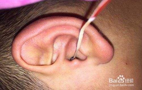 如何保护宝宝的小耳朵