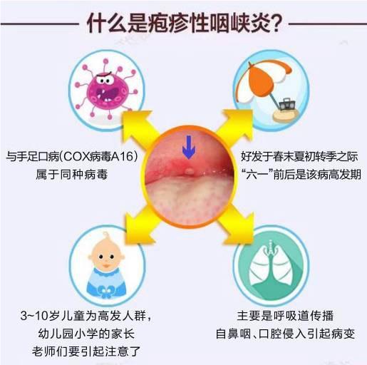 小儿疱疹性咽峡炎的症状有哪些