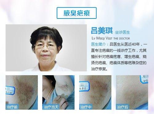 无痛分娩的利弊有哪些