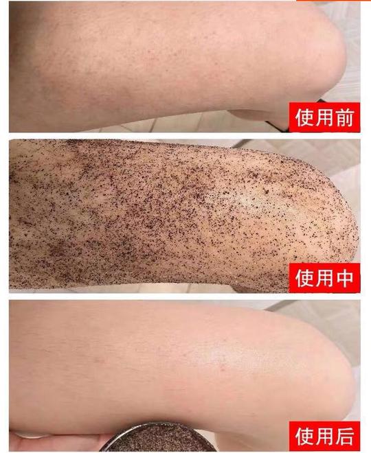 官方正品慕霖兮咖啡紧致按摩海盐弥尚去鸡皮蛇皮鱼鳞妊娠纹全身用