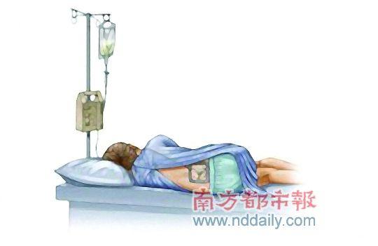 顺产打无痛针有什么后遗症