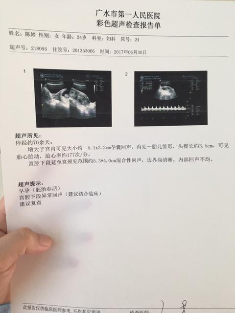 孕30周可以性生活吗