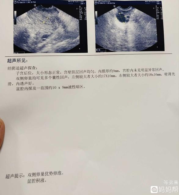 卵泡为什么会萎缩