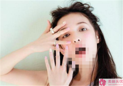 黑眼圈很重怎么消除