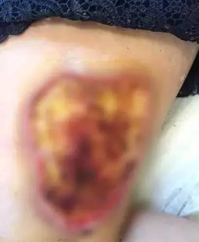 夏季蚊子出没时间