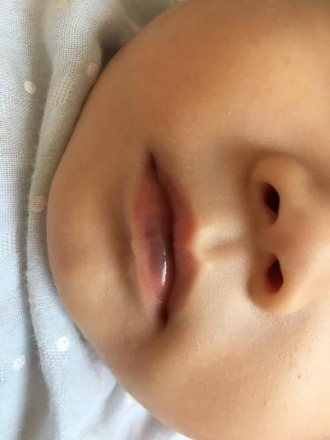 婴儿嘴唇发紫原因与处理婴儿嘴唇发紫的原因